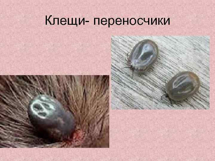 Клещи- переносчики 