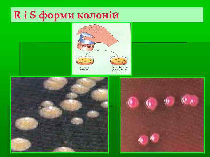R і S форми колоній 