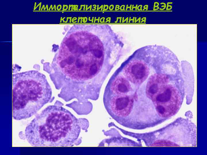 Иммортализированная ВЭБ клеточная линия 