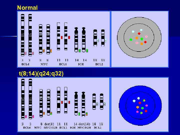 Normal t(8; 14)(q 24; q 32) 