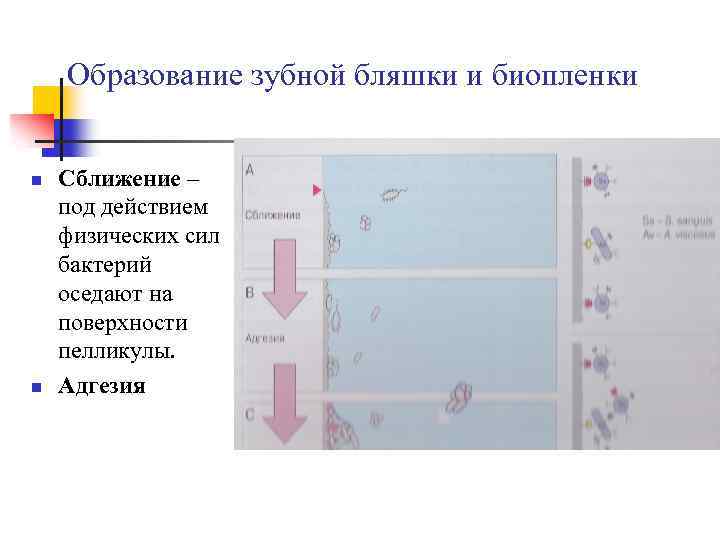 Схема формирования зубной бляшки