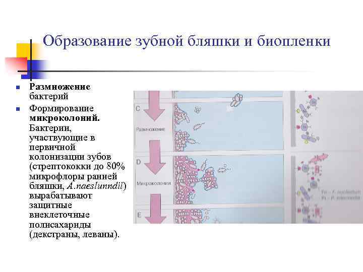 Схема формирования зубной бляшки