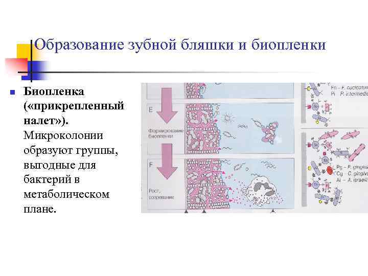 Схема формирования зубной бляшки