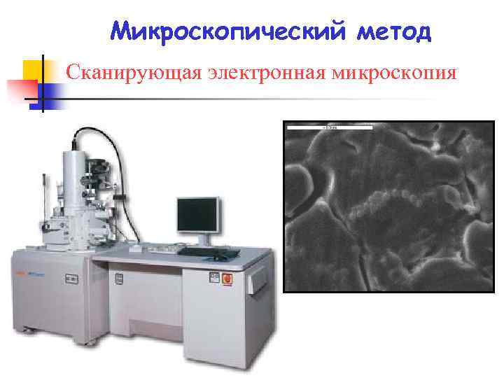 Электронная методика. Метод электронной микроскопии. Метод сканирующей (растровой) электронной микроскопии. Метод сканирующей электронной микроскопии. Метод электрической микроскопии.