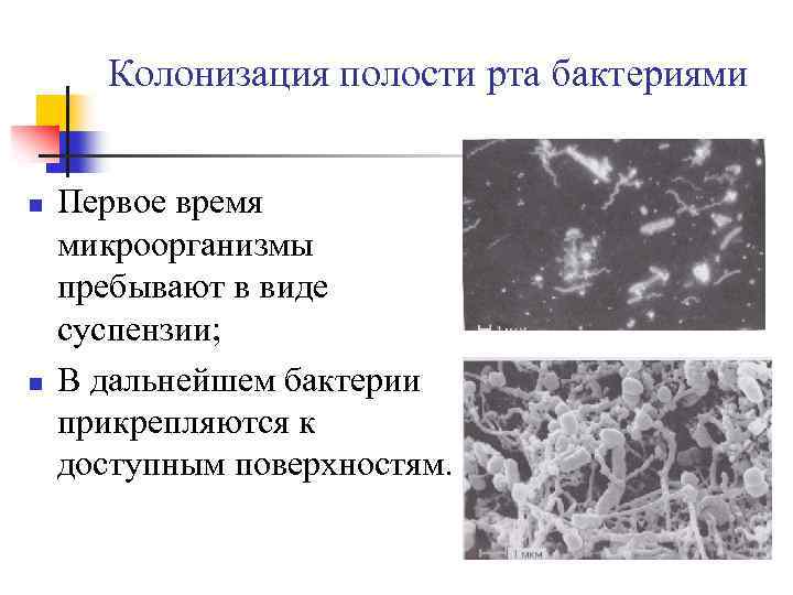 Микрофлора зубного налета микробиология презентация