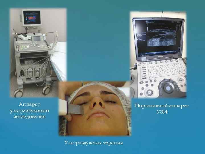Аппарат ультразвукового исследования Портативный аппарат УЗИ Ультразвуковая терапия 