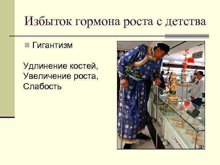 Избыток гормона роста с детства n Гигантизм Удлинение костей, Увеличение роста, Слабость 