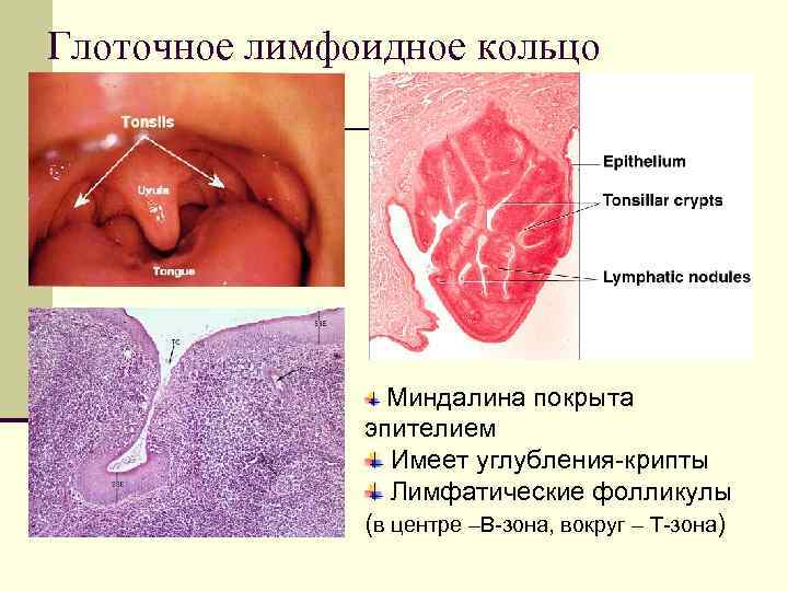 Глоточное лимфоидное кольцо     Миндалина покрыта    эпителием 