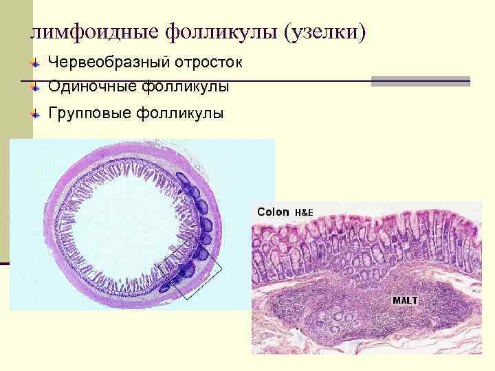 лимфоидные фолликулы (узелки) Червеобразный отросток Одиночные фолликулы Групповые фолликулы 