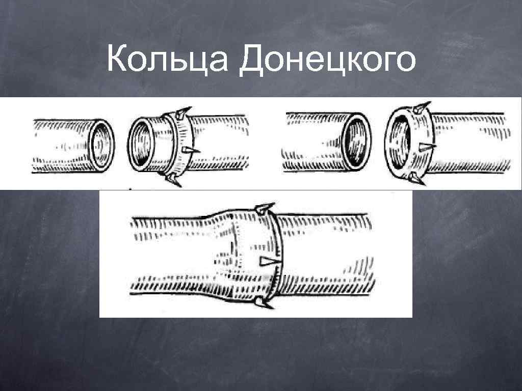 Кольца Донецкого 