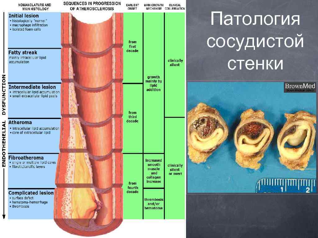 Белов руководство по сосудистой хирургии с атласом оперативной техники