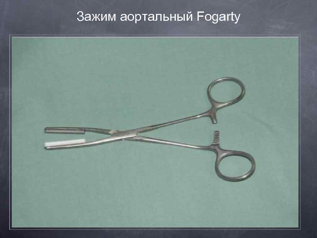 Зажим аортальный Fogarty 