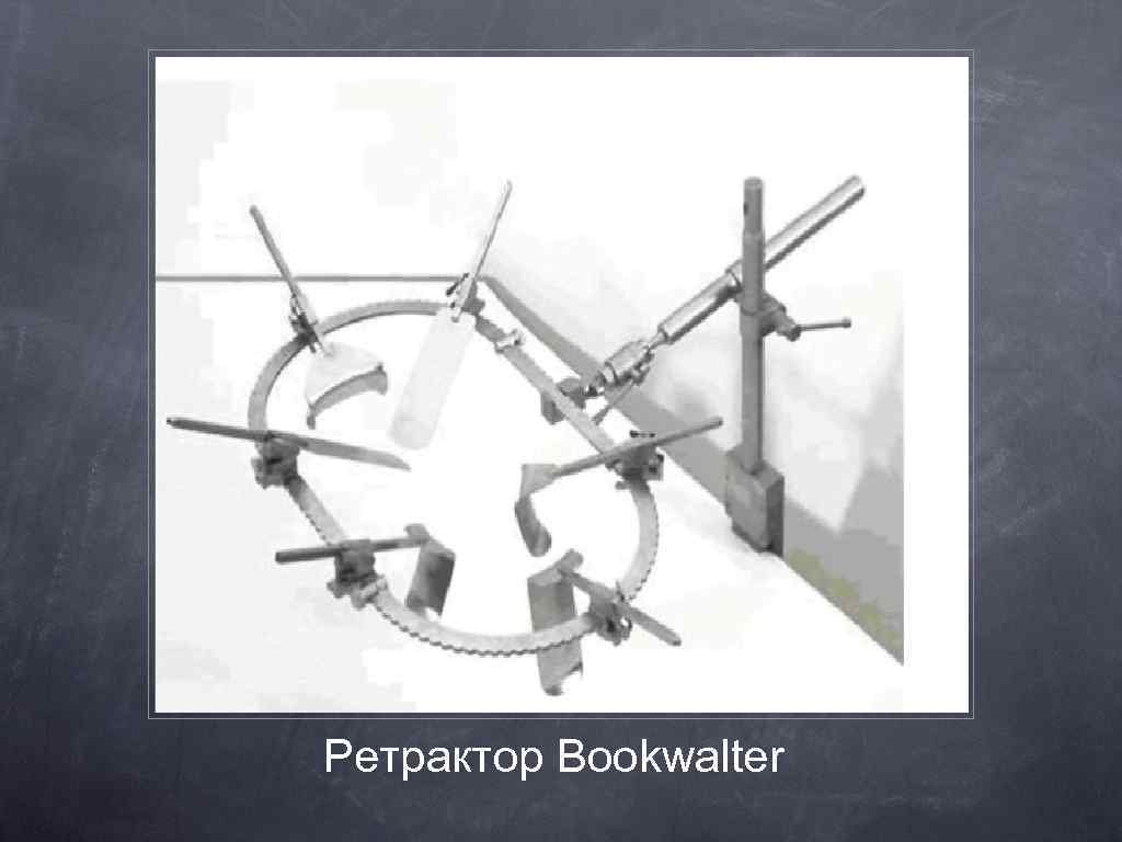 Ретрактор Bookwalter 