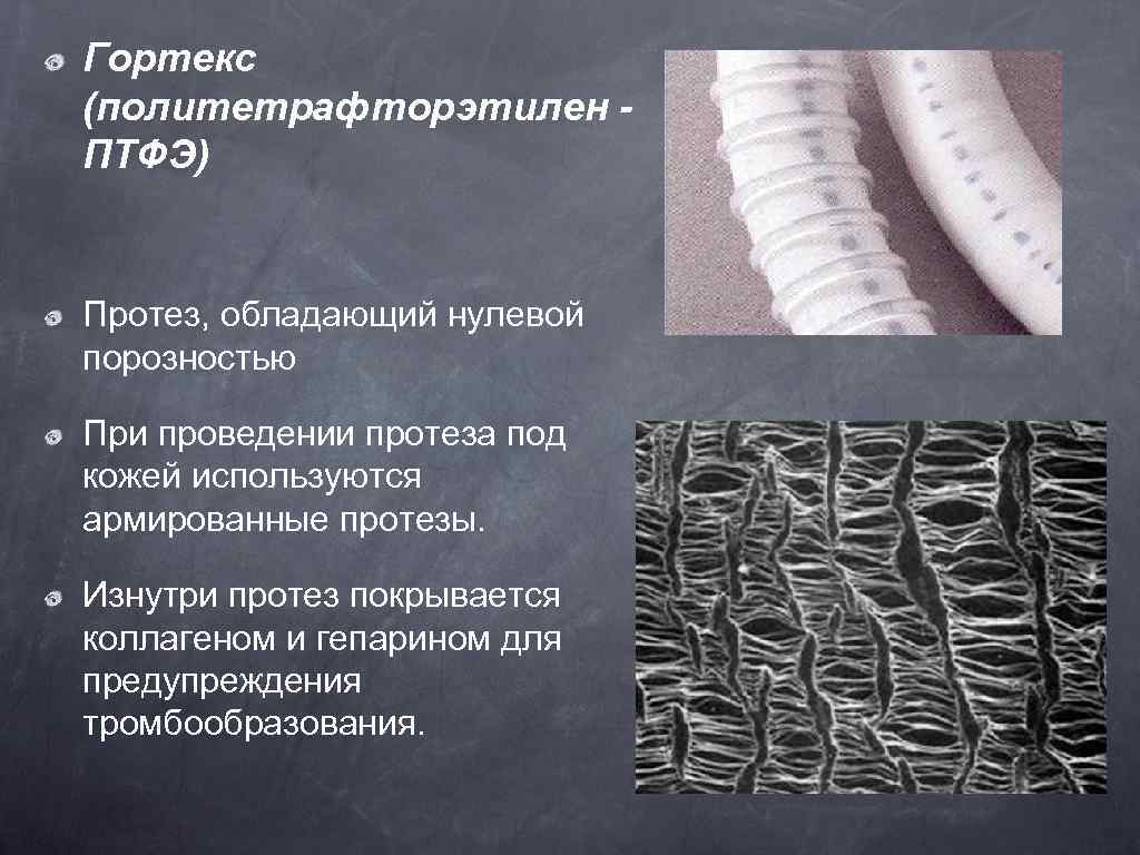 Гортекс (политетрафторэтилен ПТФЭ) Протез, обладающий нулевой порозностью При проведении протеза под кожей используются армированные
