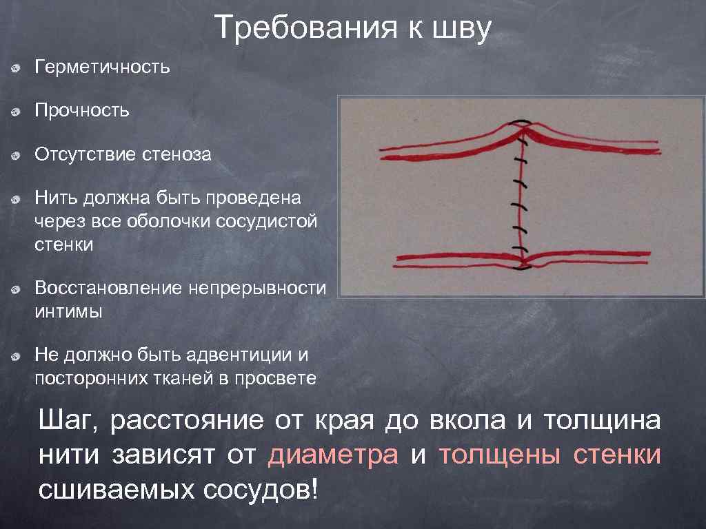 Нить должна быть. Требования к сосудистому шву. Требования к наложению сосудистого шва.