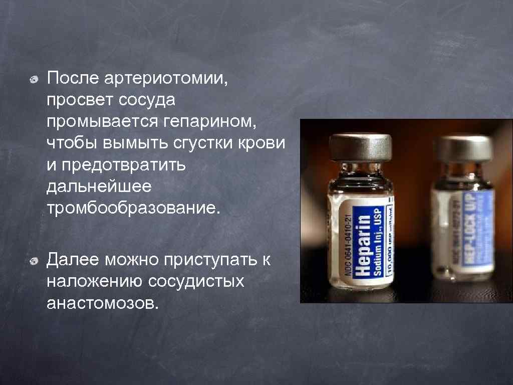 После артериотомии, просвет сосуда промывается гепарином, чтобы вымыть сгустки крови и предотвратить дальнейшее тромбообразование.