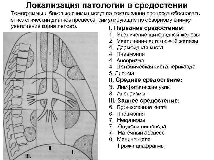 Локализация патологии в средостении Томограммы и боковые снимки могут по локализации процесса обосновать этиологический