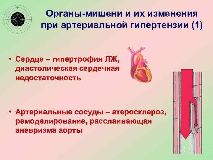 Сосуды при артериальной гипертензии. Артериальная гипертензия гемодинамика. При АГ гипертрофируется:. Артериальный кровоток гипертонического типа. Органы мишени при артериальной