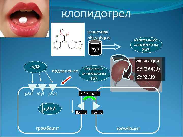 Пхт по схеме vcd