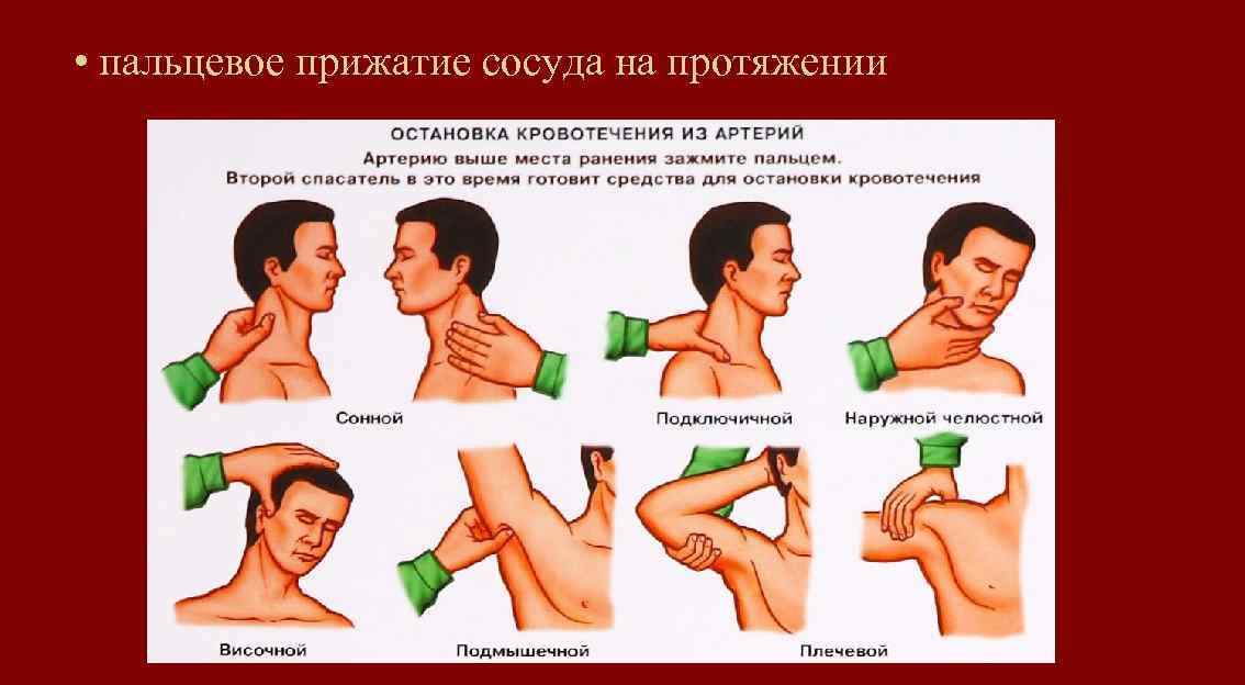 Основные способы кровотечения при ранении головы