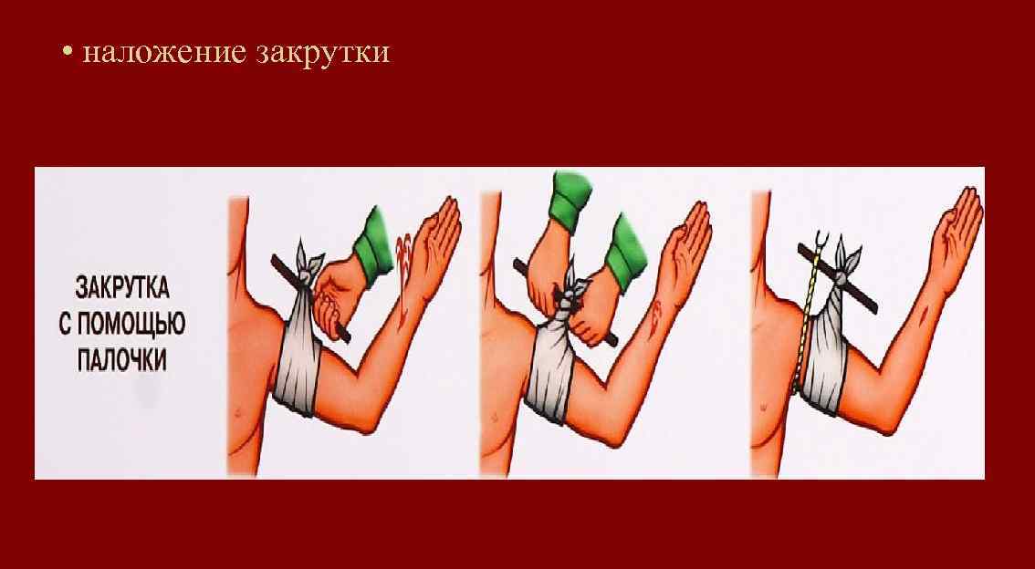  • наложение закрутки 