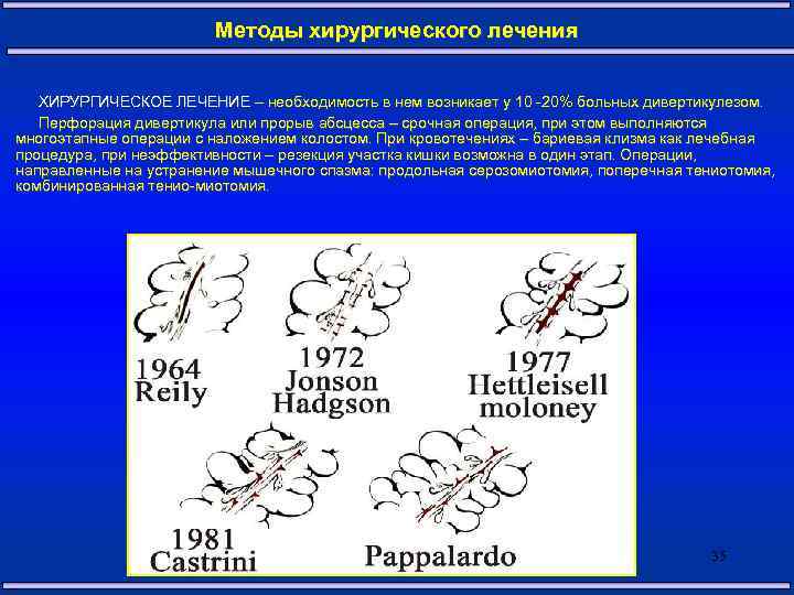 Методы хирургического лечения ХИРУРГИЧЕСКОЕ ЛЕЧЕНИЕ – необходимость в нем возникает у 10 -20% больных