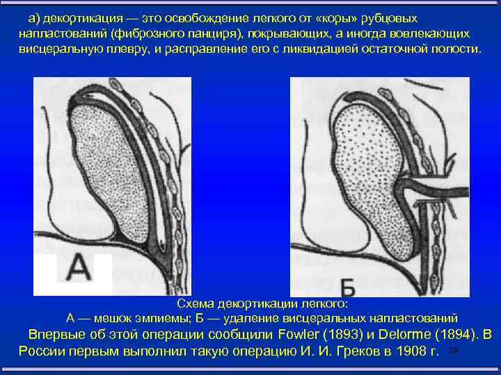 а) декортикация — это освобождение легкого от «коры» рубцовых напластований (фиброзного панциря), покрывающих, а