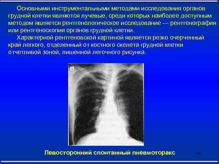 На рентгенограмме органов грудной клетки легочный рисунок в норме является