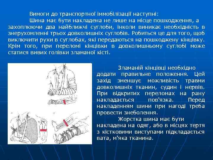 Вимоги до транспортної іммобілізації наступні: Шина має бути накладена не лише на місце пошкодження,