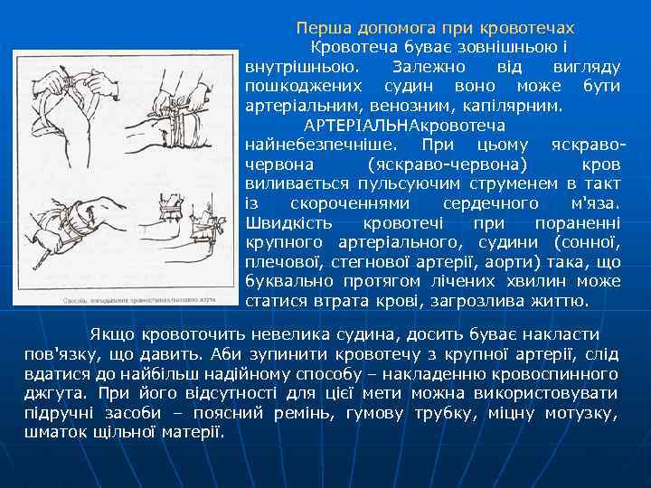 Перша допомога при кровотечах Кровотеча буває зовнішньою і внутрішньою. Залежно від вигляду пошкоджених судин