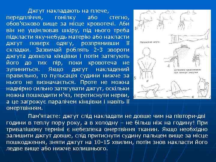 Джгут накладають на плече, передпліччя, гомілку або стегно, обов'язково вище за місце кровотечі. Аби