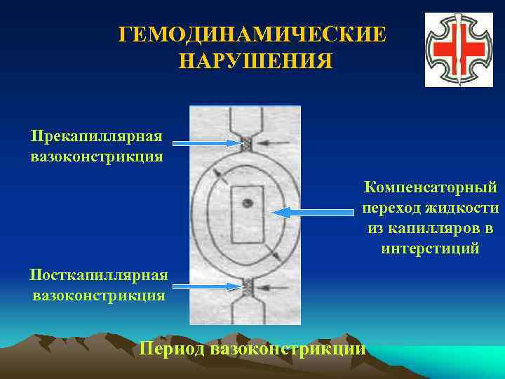 ГЕМОДИНАМИЧЕСКИЕ НАРУШЕНИЯ Прекапиллярная вазоконстрикция Компенсаторный переход жидкости из капилляров в интерстиций Посткапиллярная вазоконстрикция Период