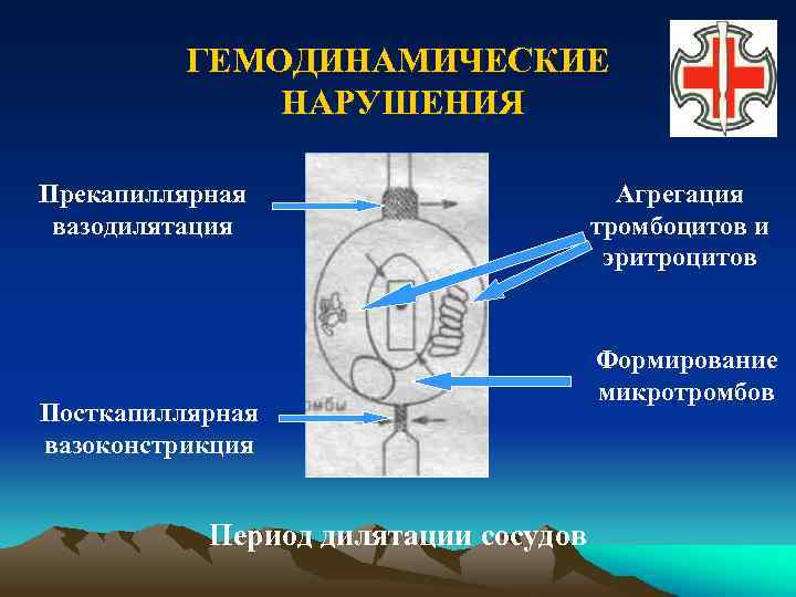 ГЕМОДИНАМИЧЕСКИЕ НАРУШЕНИЯ Прекапиллярная вазодилятация Посткапиллярная вазоконстрикция Период дилятации сосудов Агрегация тромбоцитов и эритроцитов Формирование