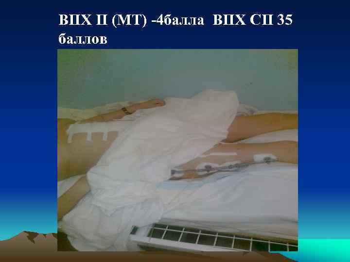 ВПХ П (МТ) -4 балла ВПХ СП 35 баллов 