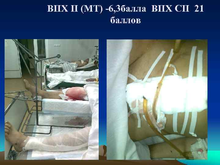 ВПХ П (МТ) -6, 3 балла ВПХ СП 21 баллов 