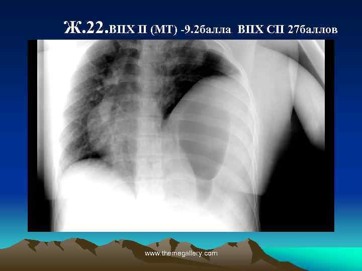 Ж. 22. ВПХ П (МТ) -9. 2 балла www. themegallery. com ВПХ СП 27