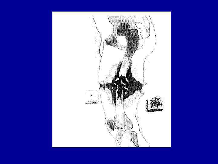 Реакции организма на травму • Общая реакция – • - Катаболическая ( 1 Реакции организма на травму • Общая реакция – • - Катаболическая ( 1