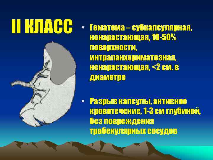 II КЛАСС • Гематома – cубкапсулярная, ненарастающая, 10 -50% поверхности, интрапанхериматозная, ненарастающая, <2 см.