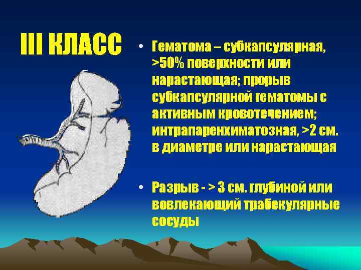 III КЛАСС • Гематома – субкапсулярная, >50% поверхности или нарастающая; прорыв субкапсулярной гематомы с