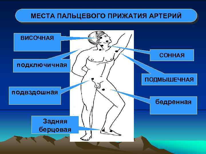 МЕСТА ПАЛЬЦЕВОГО ПРИЖАТИЯ АРТЕРИЙ ВИСОЧНАЯ СОННАЯ подключичная ПОДМЫШЕЧНАЯ подвздошная бедренная Задняя берцовая 