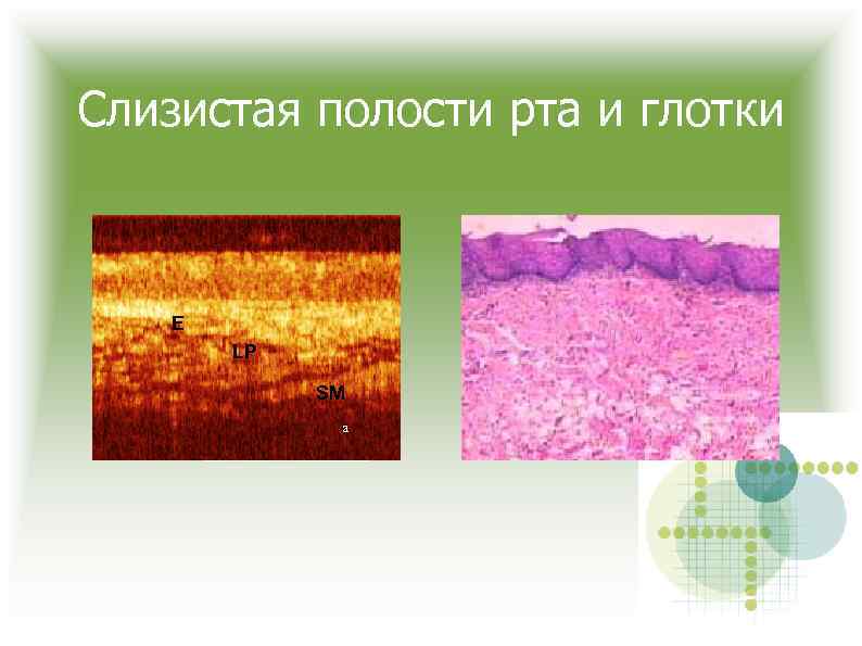 Слизистая полости рта и глотки E LP SM а 