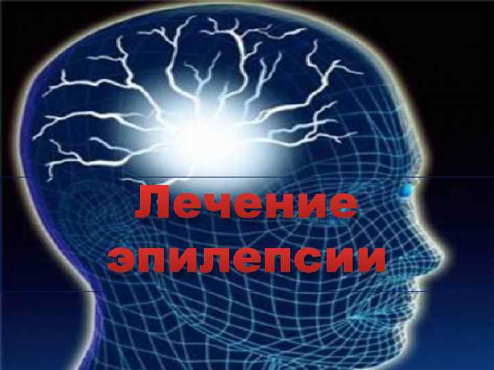 Лечение эпилепсии 