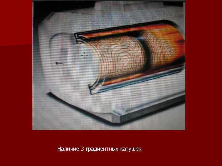 Наличие 3 градиентных катушек 