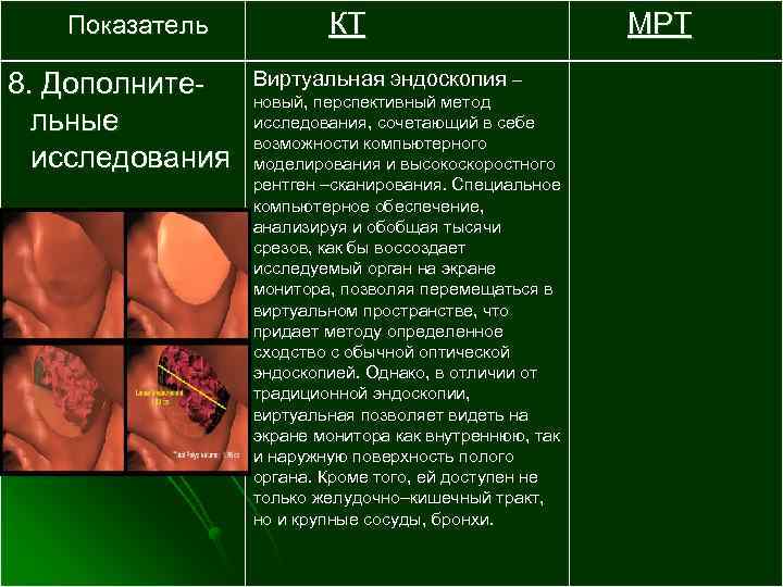 Показатель 8. Дополнительные исследования КТ Виртуальная эндоскопия – новый, перспективный метод исследования, сочетающий в