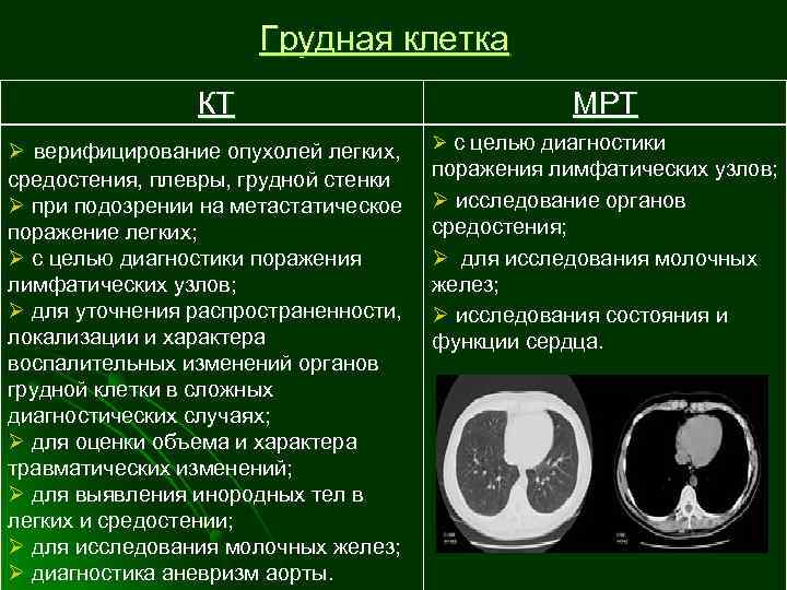 Грудная клетка КТ Ø верифицирование опухолей легких, средостения, плевры, грудной стенки Ø при подозрении
