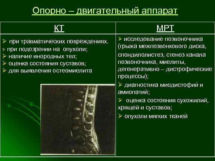 Опорно – двигательный аппарат КТ Ø при травматических повреждениях. Ø при подозрении на опухоли;