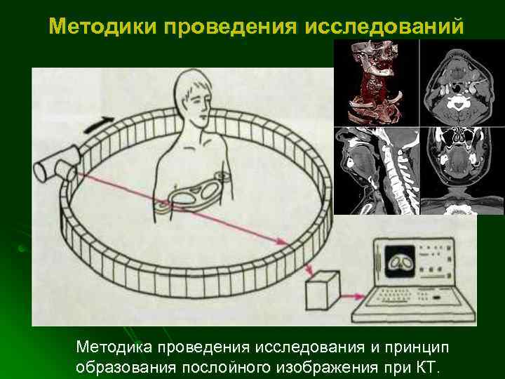 Методики проведения исследований Методика проведения исследования и принцип образования послойного изображения при КТ. 