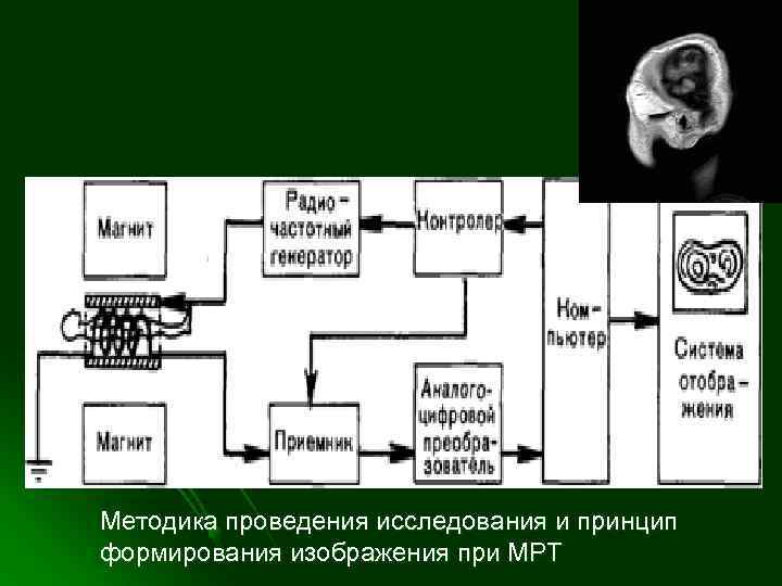 Методика проведения исследования и принцип формирования изображения при МРТ 