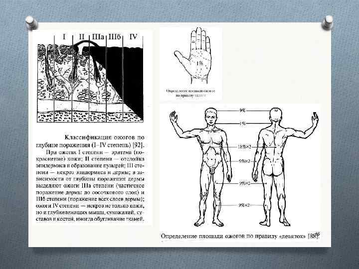 Судебная медицина в схемах и рисунках