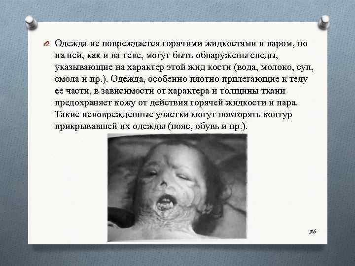 O Одежда не повреждается горячими жидкостями и паром, но на ней, как и на